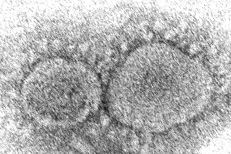 A view of Sars-CoV-2 virus particles, which cause Covid-19. AP