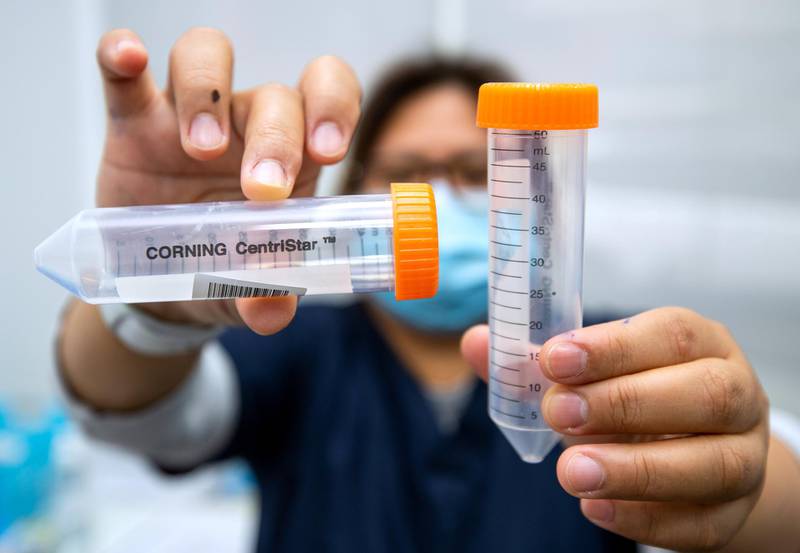 Abu Dhabi, United Arab Emirates, March 18, 2021.  A healthcare worker holds up a couple of sample saliva vials at the Biogenix lab at G42 in Masdar City.Victor Besa/The NationalSection:  NAReporter:  Shireena Al Nowais