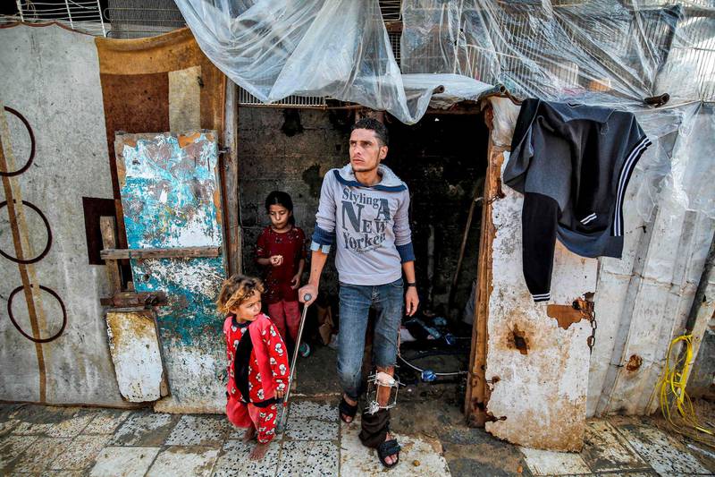Murad al-Wadyah, a Palestinian youth who was previously injured in a prior demonstration, leans on a crutch as he stands outside his home in Gaza City.  AFP