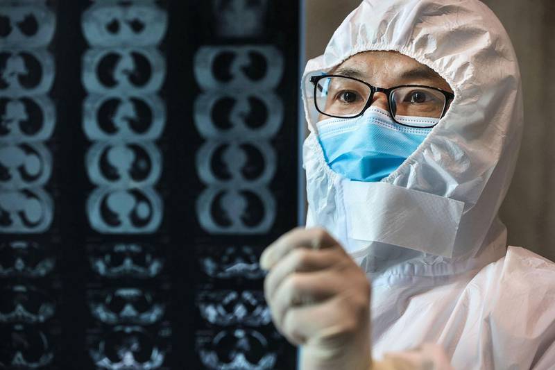 This photo taken on February 20, 2020 shows a doctor looking at a lung CT image at a hospital in Yunmeng county, Xiaogan city, in China's central Hubei province. China on February 21 touted a big drop in new cases of the coronavirus as a sign it has contained the epidemic, but fears grew abroad after two former passengers of a quarantined cruise ship died in Japan and a cluster of infections increased in South Korea. - China OUT
 / AFP / STR
