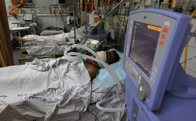 Wounded Palestinian demonstrator Haitham Abu Sabla, 23, who was hit in the face with a tear gas canister fired by Israeli troops during a protest marking al-Quds Day, (Jerusalem Day), lies on a bed at a hospital Intensive Care Unit (ICU) in the southern Gaza Strip June 8, 2018. REUTERS/Ibraheem Abu Mustafa