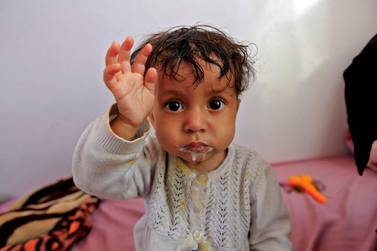 A Yemeni child suffering from malnutrition is fed at a hospital in the capital Sanaa. AFP