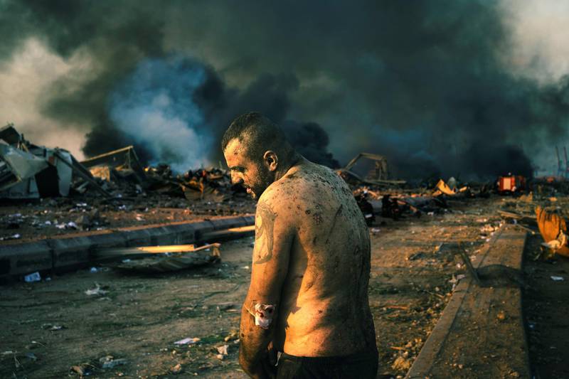 BEIRUT, LEBANON - AUGUST 4:
An injured man stands inside the wrecked site of the port of Beirut while firefighters work to put out the fires that engulfed the warehouses after the explosion.
(Photo by Lorenzo Tugnoli/ Contrasto for The Washington Post)