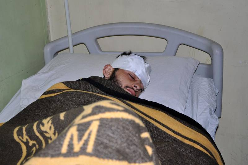 A wounded Syrian pro-regime fighter is pictured in a hospital in Syria's eastern city of Deir Ezzor on February 8, 2018.
The Syrian government blasted deadly US-led coalition air strikes on pro-regime forces in the country's east as a "war crime". In a letter addressed to the United Nations Secretary General, the foreign ministry said the attack "represents a war crime and a crime against humanity". 
 / AFP PHOTO / STRINGER