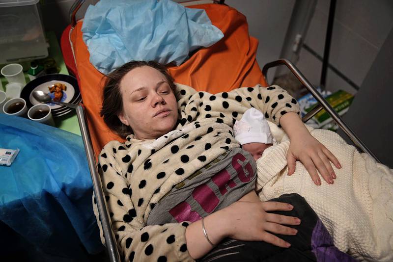 Mariana Vishegirskaya lies in a hospital bed after giving birth to her daughter Veronika in Mariupol, Ukraine, on Friday. AP